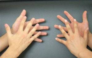 Doğuştan sağır ama 4 dil biliyor