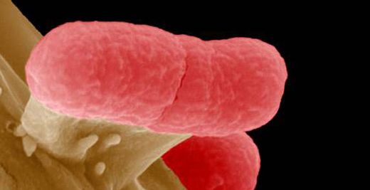 ''EHEC'' hızla yayılıyor!