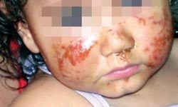 Kreşte küçük bir sorun var