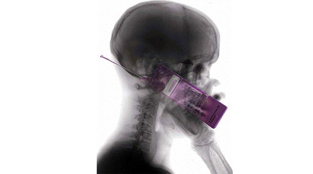 Cep telefonu gerçekten beyin tümörüne yol açıyor mu?