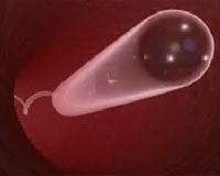 Küçük robotlar insan bedeninde dolaşacak!