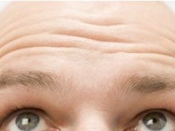 Erkeklerde kelliğin sırrı çözüldü