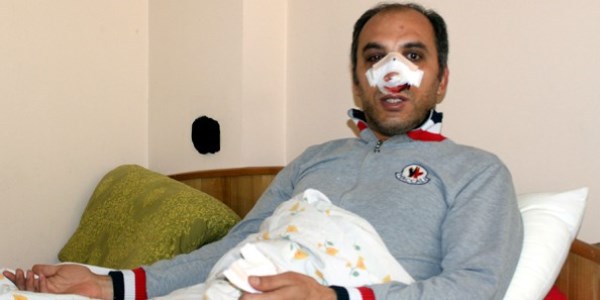 Sivil polis diye öğretmeni hastanelik ettiler!