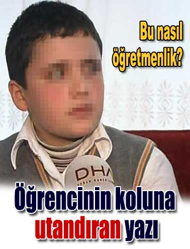 Milli Eğitim, öğrencinin koluna not yazılması olayıyla ilgili inceleme başlattı