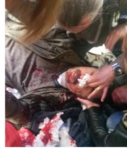 Polis öğretmene dipçikle vurdu