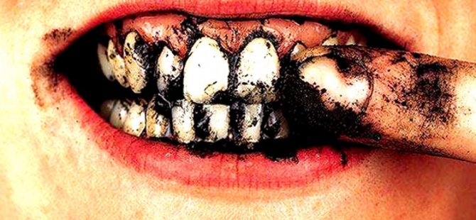 İşte Dişleri Bembeyaz Yapmanın Beş Kolay Yolu