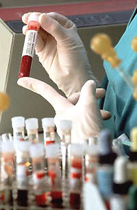 Hanta virüsü biyolojik saldırı mı?