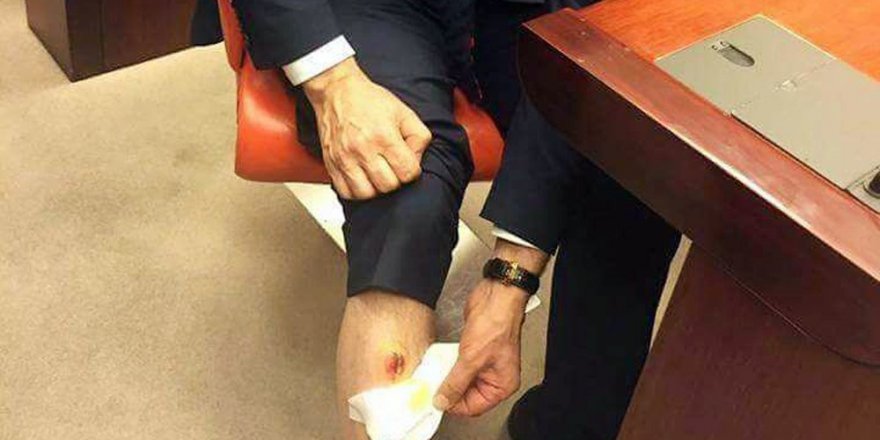 CHP’li vekil AK Partili vekili bacağından ısırdı