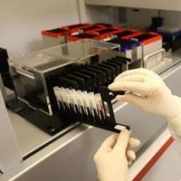 İzmirde domuz gribi paniği