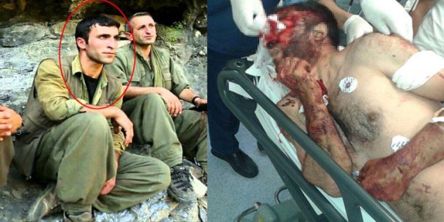 İşte o teröristin son hali!