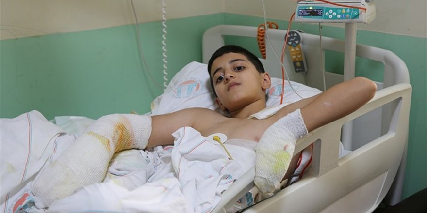 'Ben yandım başka çocuklar yanmasın'