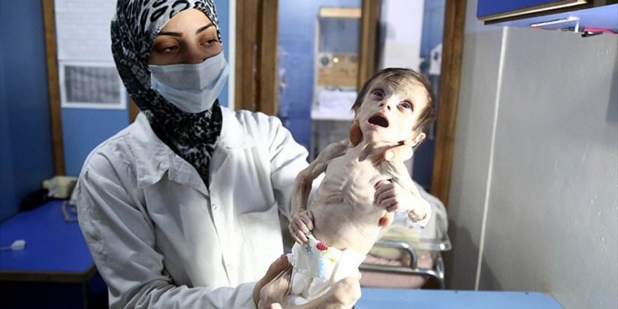 Doğu Guta'da çocuklar yarım öğünle gün geçiriyor