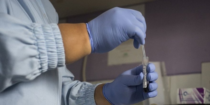 'HIV en çok 25-35 yaşlarında görülüyor'