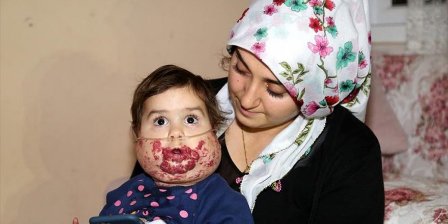 'Tek hayalim çocuğumun nefes alabildiğini görebilmek'