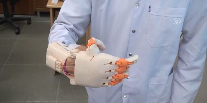 Lise öğrencileri, 15 yaşındaki kıza protez el geliştirdi