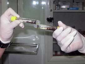 En garip 10 hastalık