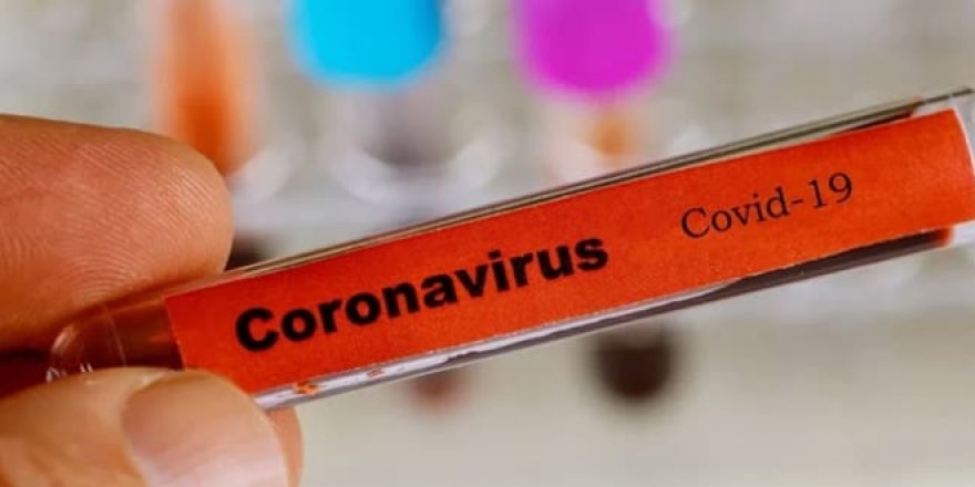 Corona virüs aşısı yakında elimizde olabilir