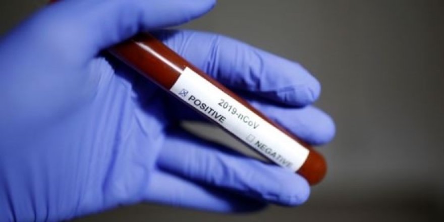 Çinli bilim adamı virüsün biteceği tarihi açıkladı