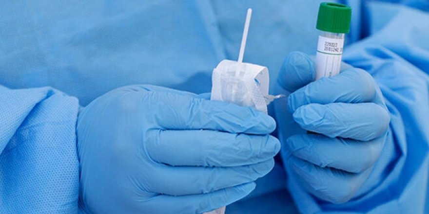 1250 TL'ye koronavirüs testi!