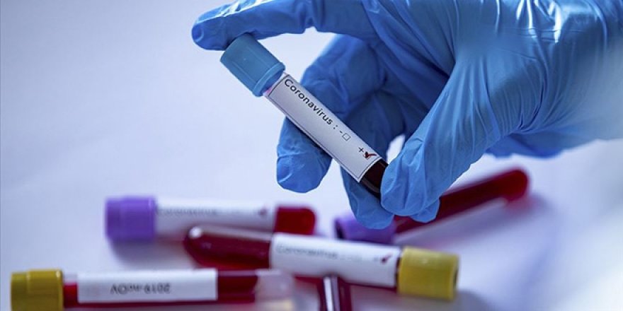 Koronavirüs ile ilgili bilinen her şeyi değiştirecek iddia