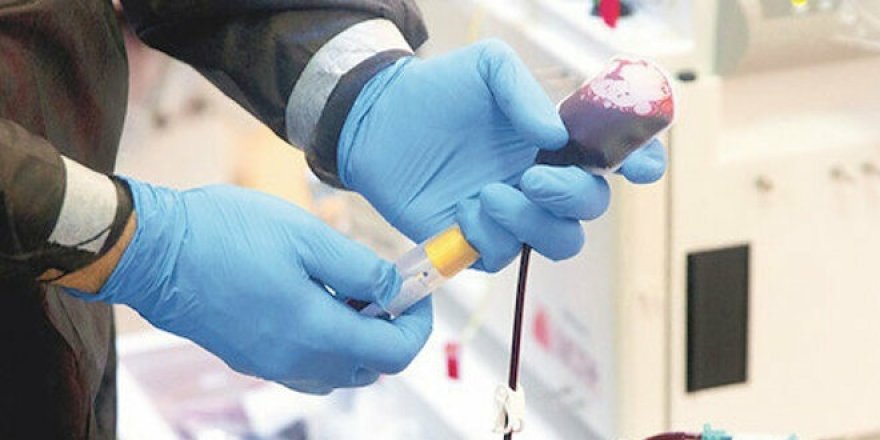 Bunlar da plazma yüzsüzü: 40 bin TL isteyen bile var