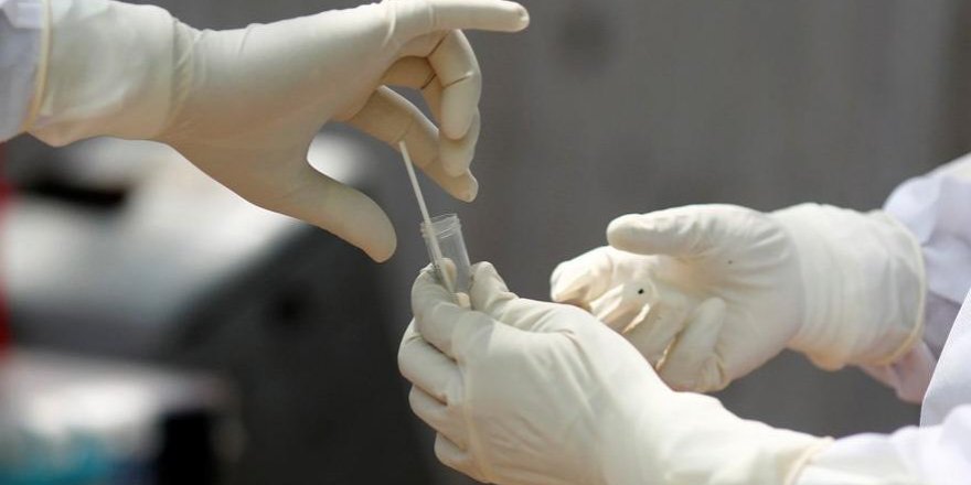 Son dakika… Corona testine ‘acil kullanım’ onayı çıktı!