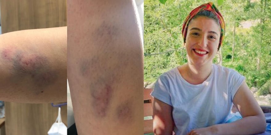 COVID-19 teşhisli şahıs Genç doktoru bu hale getirdi!