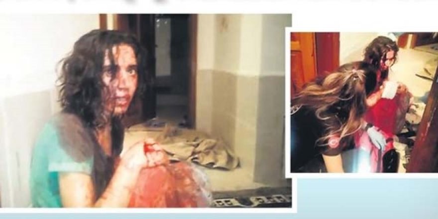 Senin gibi koca olmaz olsun! Eşini demir sopa ve cam kırıkları ile darp etti