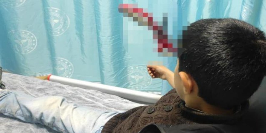 10 yaşındaki çocuk kafasına saplanan makasla hastaneye getirildi
