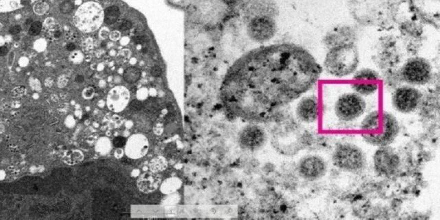 Omicron’u ilk tespit eden doktor güzel haberi verdi!