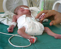 Sezaryen, genetiği bozuyor