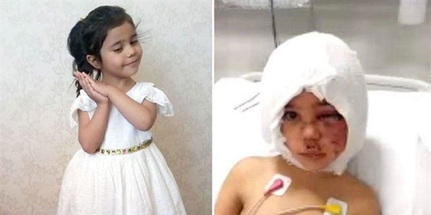 Asiye'nin yaralandığı pitbull saldırısına 2 tutuklama daha