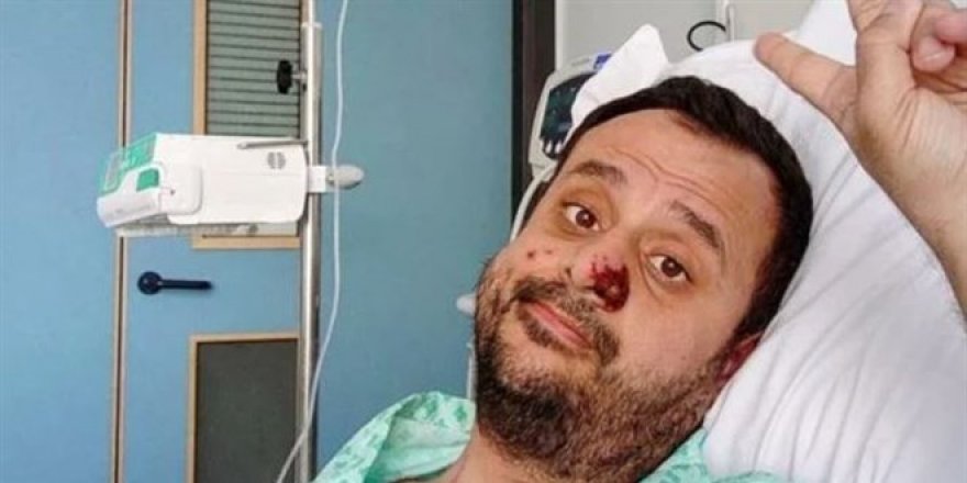 Maymun çiçeğine yakalanan Türk, DSÖ'nün gündeminde