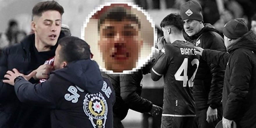 UEFA'da Türkiye'yi rezil etti... Sahaya girip rakibe saldırdı