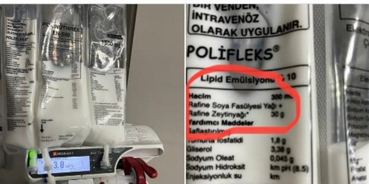 Kardiyolog Özcan Yücel'in yoğun bakım tedavisi önerisi gündem oldu