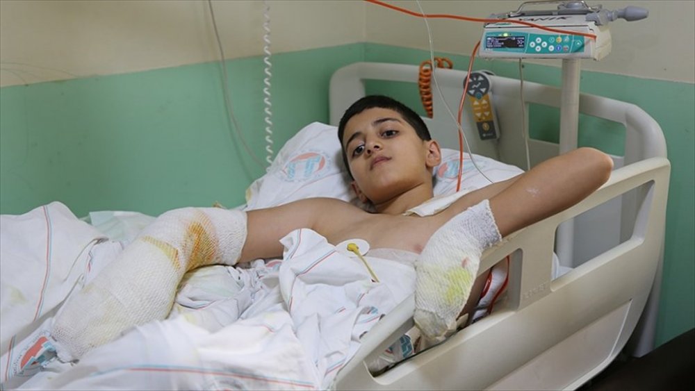 'Ben yandım başka çocuklar yanmasın'