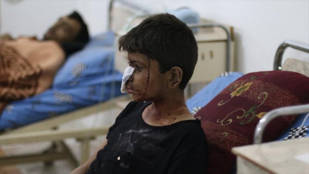 Yaralanan 12 yaşındaki Zigind: Yüzüm hep kan oldu, hastaneye koşmaya başladım