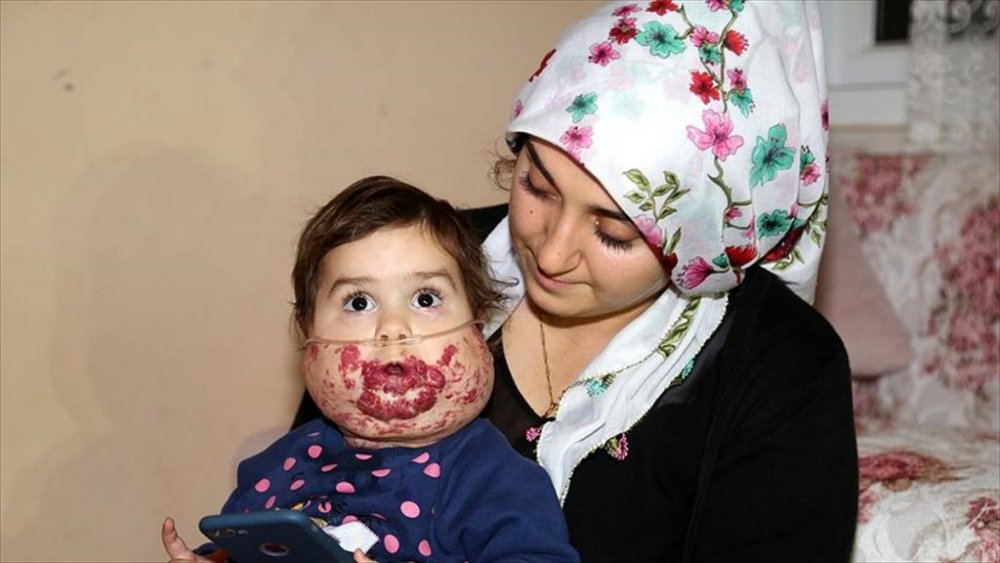 'Tek hayalim çocuğumun nefes alabildiğini görebilmek'