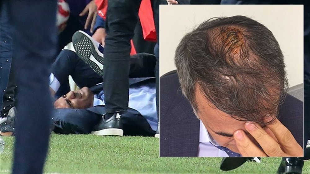 Şenol Güneş taburcu edildi